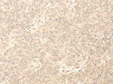 PLEKHA1 Polyclonal Antibody Reactivity Human