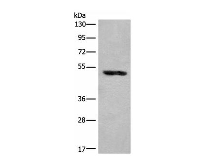 KLHDC2 Polyclonal Antibody Reactivity Human