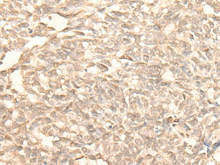 RAD23B Polyclonal Antibody Reactivity Human