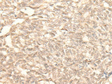 RAD23B Polyclonal Antibody Reactivity Human