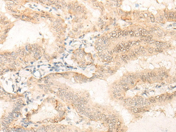 EIF4A3 Polyclonal Antibody Reactivity Human