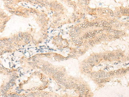 EIF4A3 Polyclonal Antibody Reactivity Human