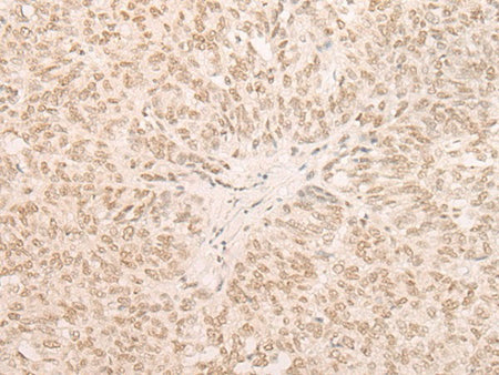 EIF4A3 Polyclonal Antibody Reactivity Human