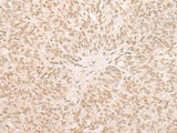 EIF4A3 Polyclonal Antibody Reactivity Human