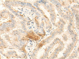 BZW2 Polyclonal Antibody