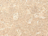 FAH Polyclonal Antibody