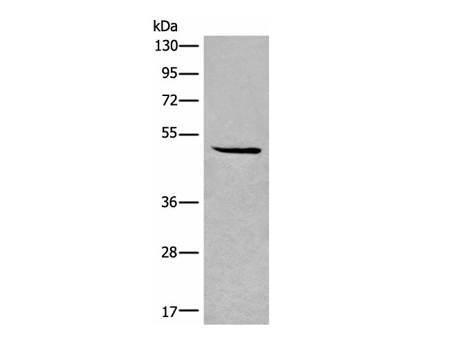 SPOCK3 Polyclonal Antibody Reactivity Human