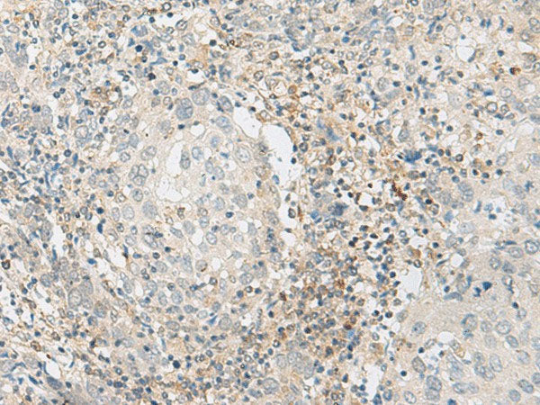 ZBTB8A Polyclonal Antibody Reactivity Human
