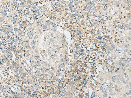 ZBTB8A Polyclonal Antibody Reactivity Human