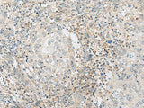 ZBTB8A Polyclonal Antibody Reactivity Human