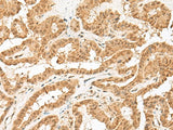 ZBTB8A Polyclonal Antibody Reactivity Human