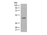 ZBTB8A Polyclonal Antibody Reactivity Human