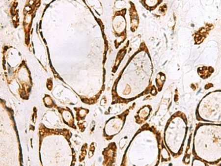 GRWD1 Polyclonal Antibody Reactivity Human