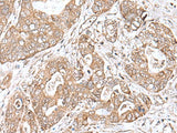 TEAD2 Polyclonal Antibody