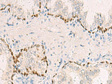 TP63 Polyclonal Antibody Reactivity Human