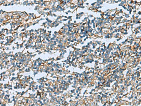 DPYSL3 Polyclonal Antibody Reactivity Human