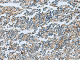 DPYSL3 Polyclonal Antibody Reactivity Human