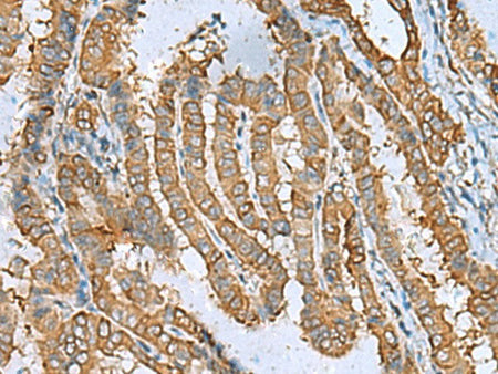 DPYSL3 Polyclonal Antibody Reactivity Human