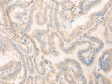 SEPT10 Polyclonal Antibody