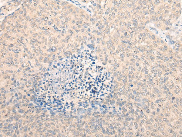 SEPT10 Polyclonal Antibody