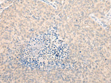 SEPT10 Polyclonal Antibody