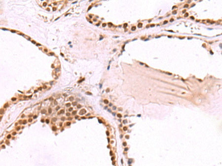 RUVBL1 Polyclonal Antibody Reactivity Human