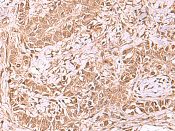 RUVBL1 Polyclonal Antibody Reactivity Human