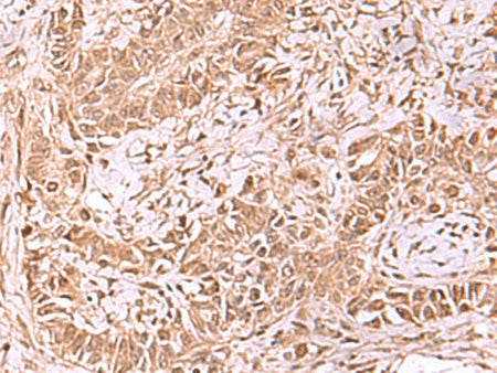 RUVBL1 Polyclonal Antibody Reactivity Human