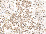 RRP1 Polyclonal Antibody Reactivity Human
