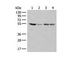 RRP1 Polyclonal Antibody Reactivity Human