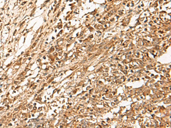 ZBTB43 Polyclonal Antibody Reactivity Human