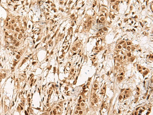 ZBTB43 Polyclonal Antibody Reactivity Human