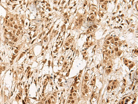 ZBTB43 Polyclonal Antibody Reactivity Human