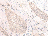 TBC1D2 Polyclonal Antibody