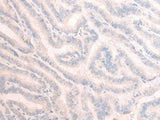 TBC1D2 Polyclonal Antibody