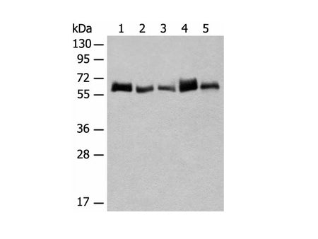 CCDC47 Polyclonal Antibody Reactivity Human
