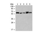 CCDC47 Polyclonal Antibody Reactivity Human