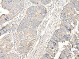 IGHA1 Polyclonal Antibody Reactivity Human