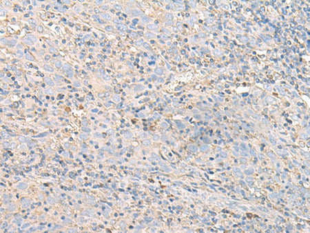 IGHA1 Polyclonal Antibody Reactivity Human