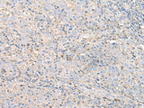IGHA1 Polyclonal Antibody Reactivity Human