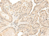 ZGPAT Polyclonal Antibody