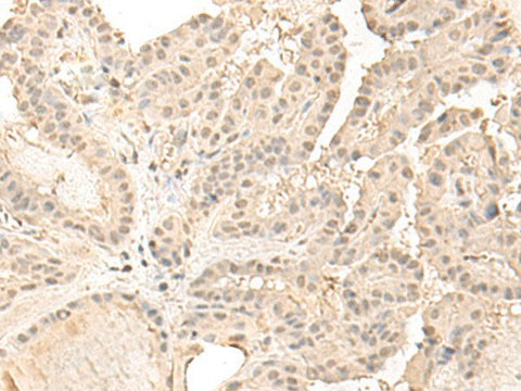 ZGPAT Polyclonal Antibody