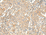 CORO2A Polyclonal Antibody Reactivity Human