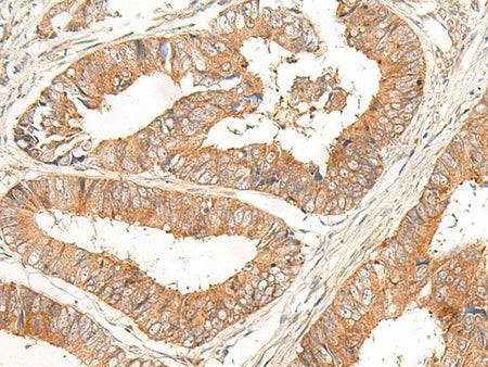 CORO2A Polyclonal Antibody Reactivity Human