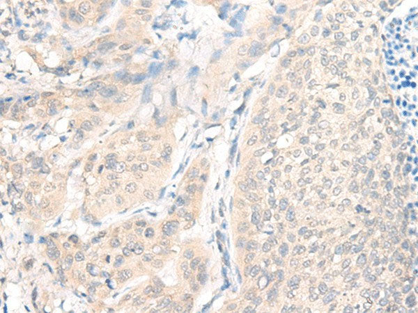 AOAH Polyclonal Antibody Reactivity Human