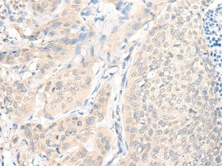 AOAH Polyclonal Antibody Reactivity Human