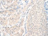 AOAH Polyclonal Antibody Reactivity Human