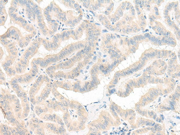 AOAH Polyclonal Antibody Reactivity Human