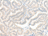 AOAH Polyclonal Antibody Reactivity Human