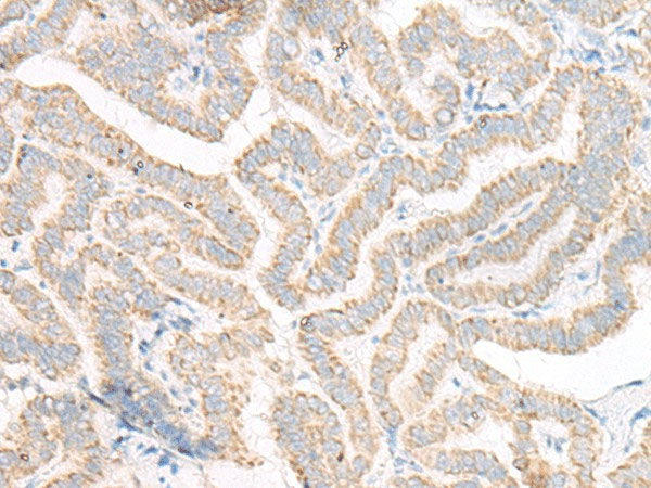 ACSF2 Polyclonal Antibody